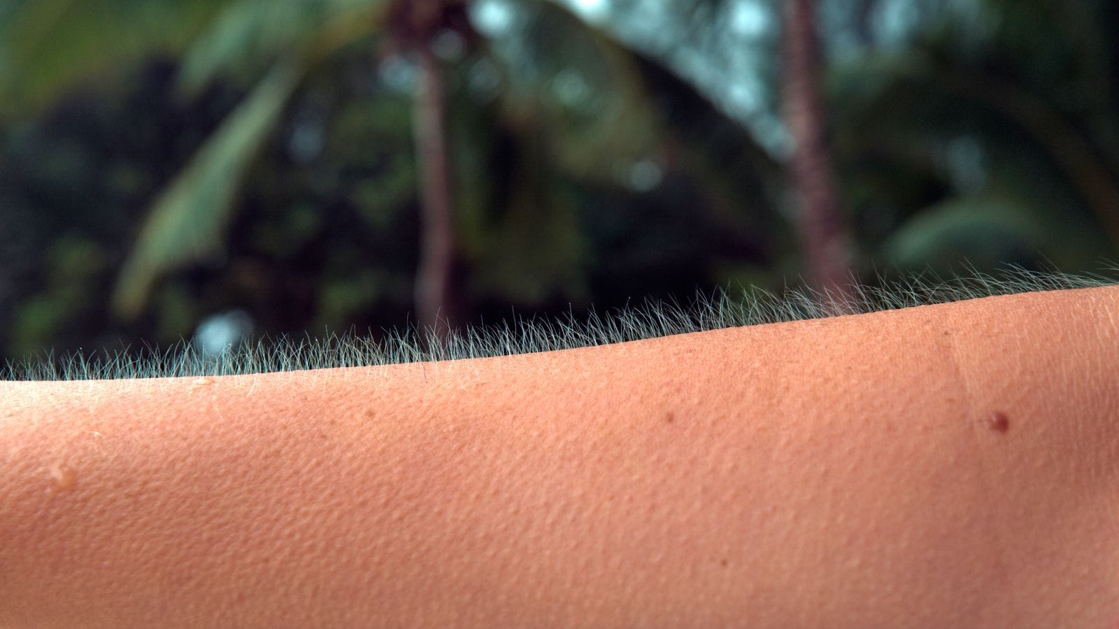 Goosebumps on an arm. Photo: Istock.